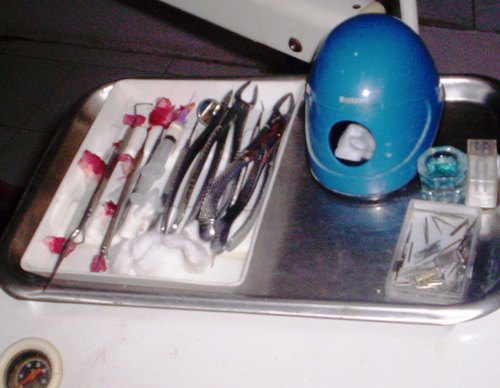 DENTAL IMPLANTS CLINIC IN PATNA