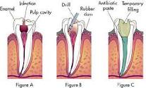 COSMETIC DENTAL TREATMENT IN PATNA CITY