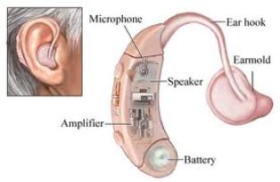 PHONAK HEARING AIDS IN PATNA