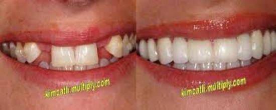 DENTAL IMPLANT CLINIC IN PATNA