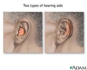 HEARING AIDS SERVICE CENTRE PATNA 