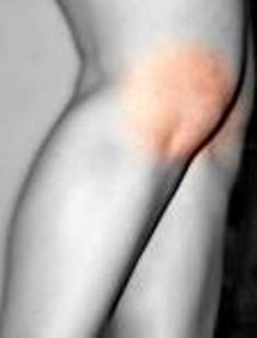 best joint pain clinic in patna bihar