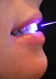 LASER DENTIST IN PATNA