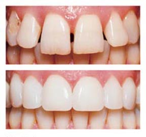 COSMETIC DENTISTRY IN BHAGALPUR