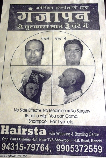 HAIR BALDNESS IN RANCHI