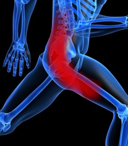 SCIATICA TREATMENT IN PATNA