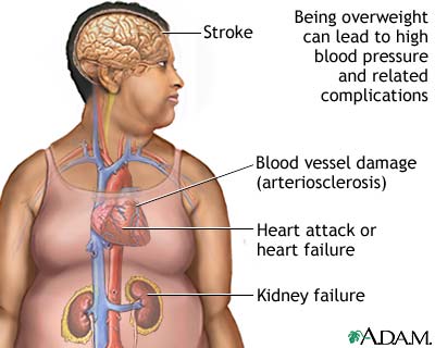 OBESITY TREATMENT IN PATNA