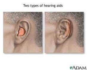 hearing aids service centre patna 