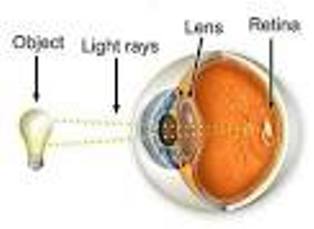 eye test centre in m pur bihar