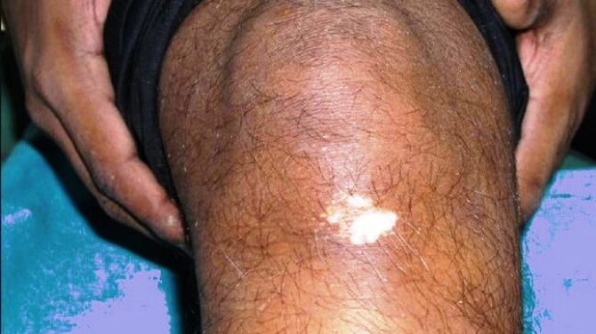 FAMOUS SKIN AND LASER CENTER IN DALTONGANJ