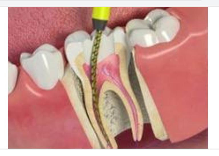 DENTIST IN HAZARIBAGH